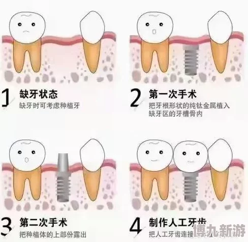 美女牙齿修复攻略：全程通关技巧与方法详解